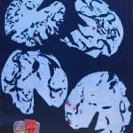 Lily Pad Insect Drawings (3)